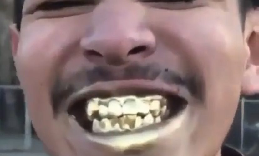 man spray paints teeth gold