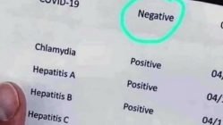 Negative COVID 19 test