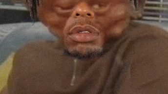 Nate Robinson swollen face Martin meme