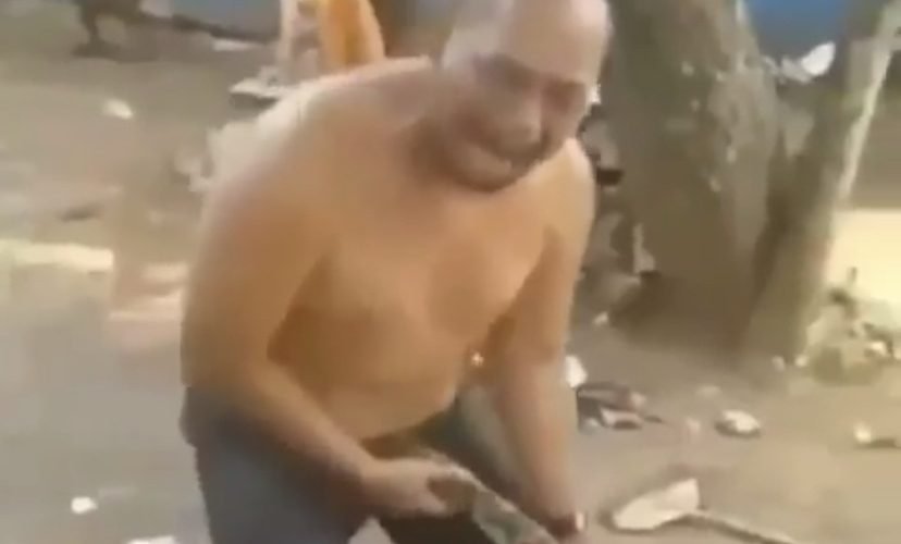 Man gets bit by snake in painful place