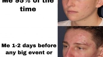 Me 95% of the time vs me 1-2 days before any big event or gathering meme